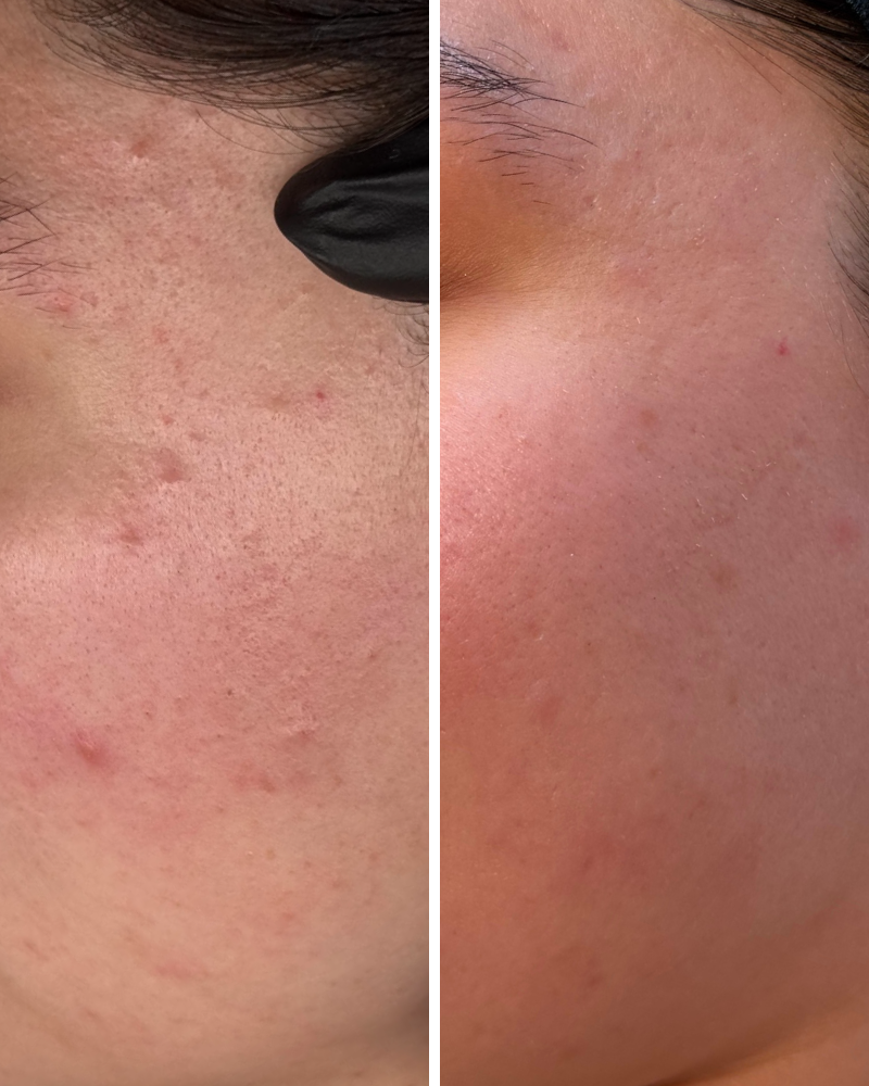 Texture Refinement Before and After